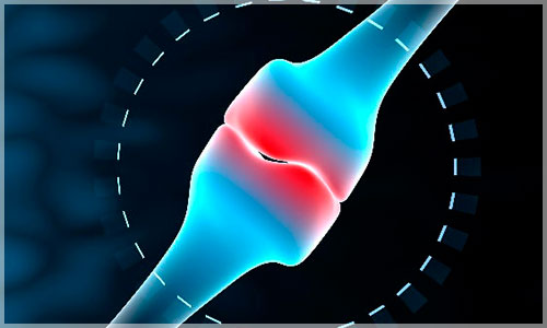 Ciruela-pasa-vs-osteoporosis