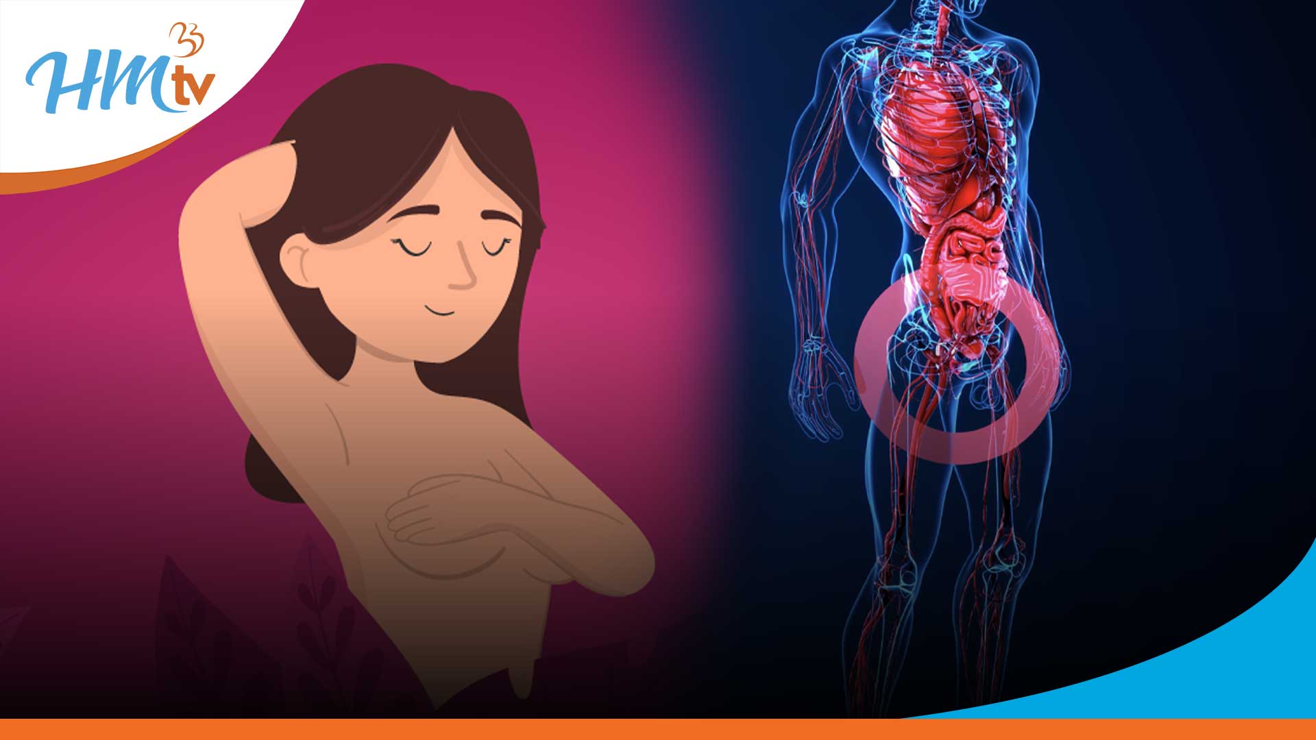Cáncer de mama y cáncer de próstata: comprender sus conexiones